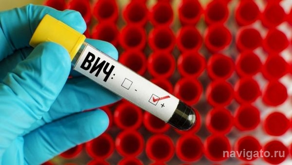 ВИЧ-статус пациента раскрыли в больнице Кольцово