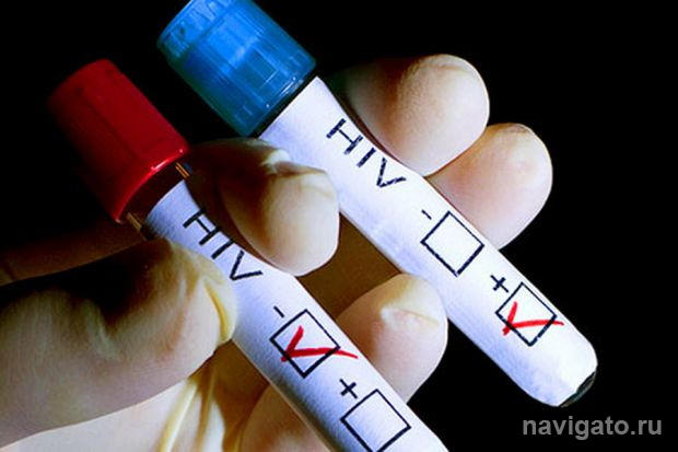 Пройти экспресс-тест на ВИЧ могут жители Советского района