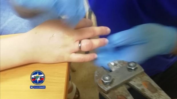 Спасатели помогли жительнице Советского района снять кольцо