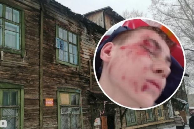 Возбудили уголовное дело из-за рухнувшей на подростка глыбы льда