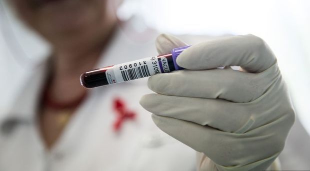 В Советском районе можно бесплатно сдать тест на ВИЧ